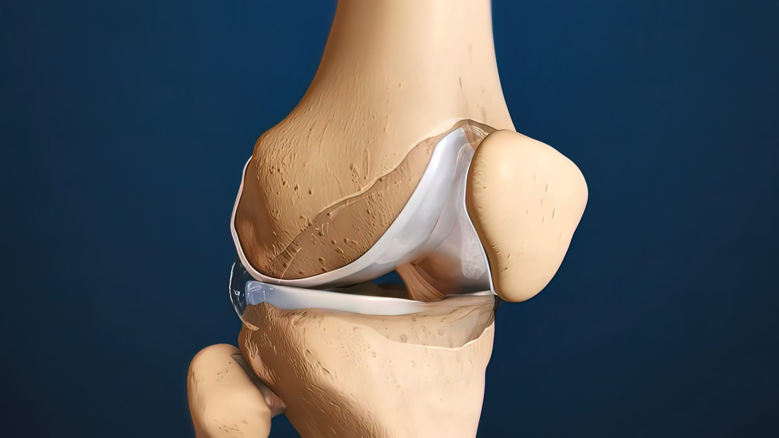 Cross,Section,Through,A,Typical,Synovial,Joint,Showing,The,Bone Knee Cartilage treated with BMAC Injection